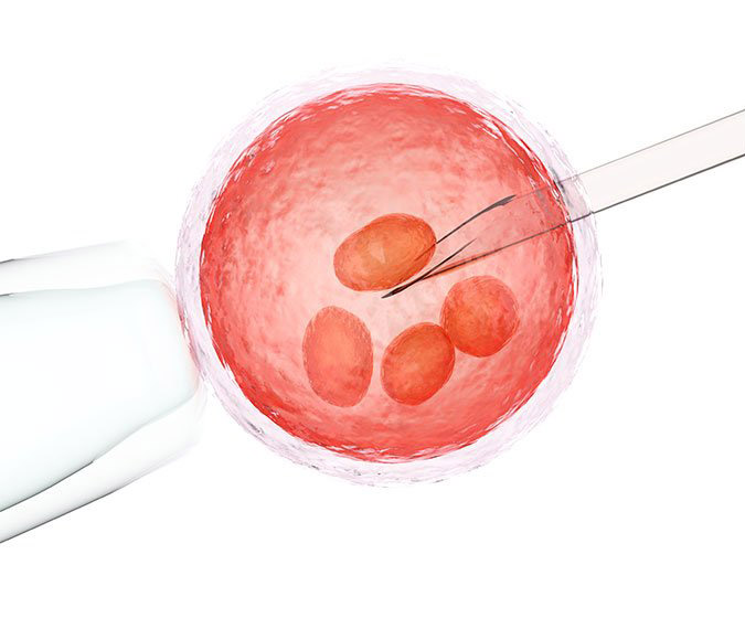La PMA, o Procreazione Medicalmente Assistita, comprende l’insieme delle metodiche che mirano a trovare un rimedio a una patologia diffusa come l’infertilità