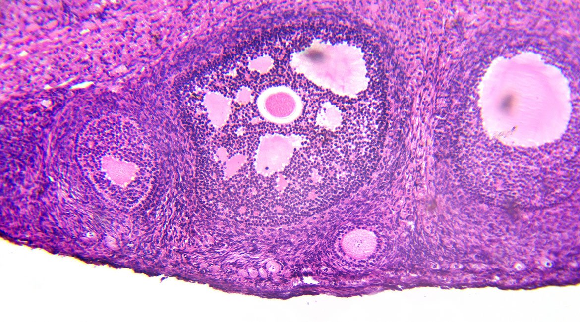 Induzione all’ovulazione mediante la somministrazione di ormoni per sollecitare la crescita dei follicoli