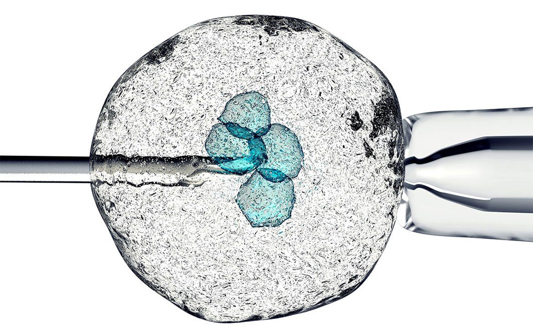 L'ICSI, iniezione intracitoplasmatica degli spermatozoi, è una tecnica di fecondazione assistita molto simile alla FIVET